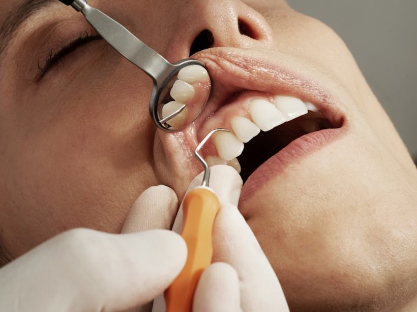 Control odontológico con espejo bucal